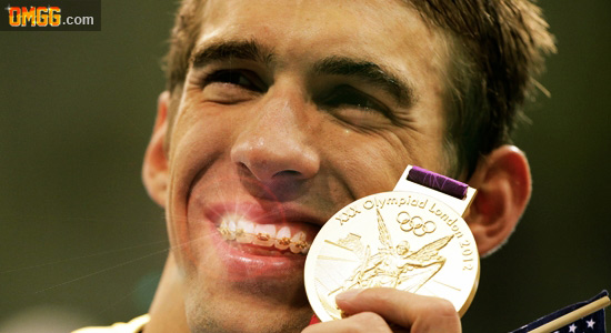 Michael Phelps has silver medals melted down into braces to fix hideous teeth